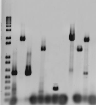 Como no pudimos detectar el mensajero de PfTert por northern blot, se intentó reconstruir el transcrito por RT-PCR.