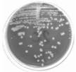 suprapúbica Recuento colonias (ufc/ml) 0 Cualquier recuento Sedimento urinario