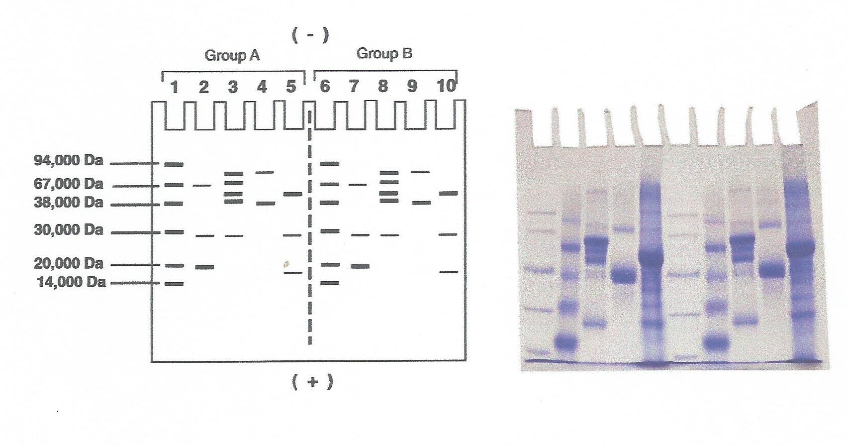 5. RESULTADOS En el esquema de abajo se muestran la relativa posición de las bandas de proteínas, pero no están dibujadas a escala.