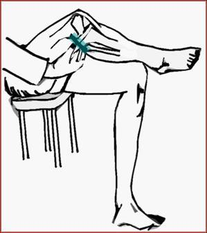 Cara anterolateral de la rodilla Se realiza la palpación de la meseta tibial externa (Fig. 6 ) y de la interlínea articular, recorriendo el borde lateral del tendón rotuliano (Fig.