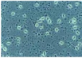 40 3.5 Enfermedades producidas por Protozoos 3.5.1 Nosemiosis Figura 9. [Nosema apis vista a través del microscopio]. por (Fomin & bid. 2009).