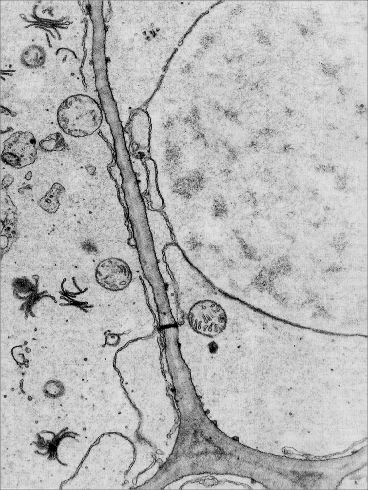 Células meristemáticas-2 Proplastidio Dictiosomas Pared 1ª Retículo
