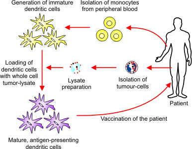 Vacunas a células dendríticas (DCs) DC alogénicas DC autólogas - Cargadas con Ag - Fusionadas a células tumorales - Expresando moléculas