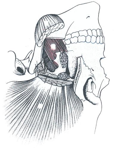 18 Anatomía funcional de la mandíbula Pterigoideo medial Este potente músculo rectangular, (8) en la figura 2.
