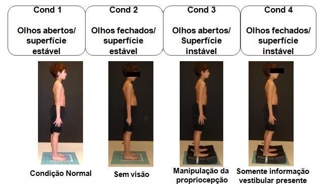 postural con la fotogrametría (evaluación cuantitativa de las asimetrías posturales) La movilidad de la cadera