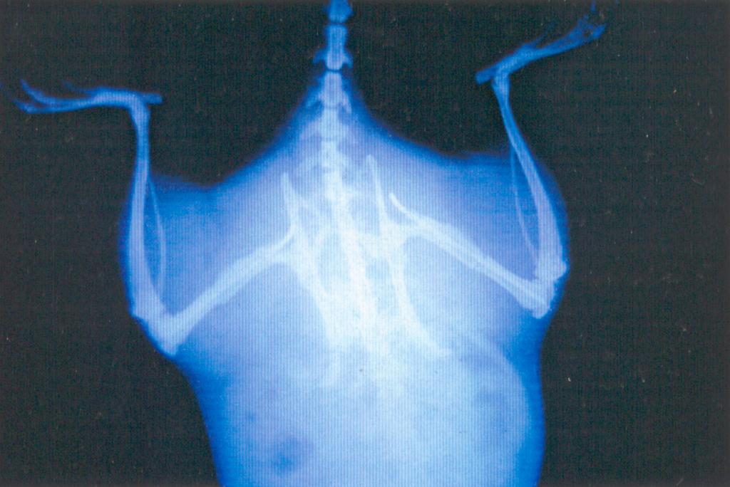 Foto 4: Corte histológico de un callo teñido con azul