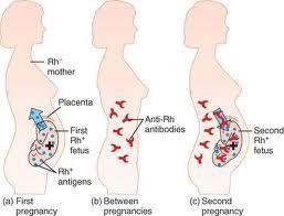 ERITROBLATOSIS FETAL Rh- Rh+ Rh+ 1. Bebé Rh+ 1. Madre Rh- y padre Rh+. Bebé Rh+. En el primer parto los eritrocitos del bebé entran en contacto con la sangre de la madre.