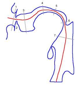Tipos de Resonancia Vibraciones de las cuerdas vocales viajan a través del aire desde la laringe hacia la cavidad de la garganta y cabeza, poniendo ambas cavidades a vibrar.