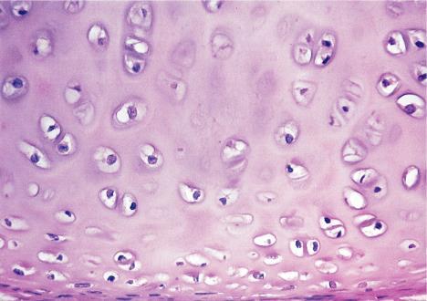 CRECIMIENTO DEL CARTÍLAGO Crecimiento intersticial: ocurre en la parte interna del cartílago en células