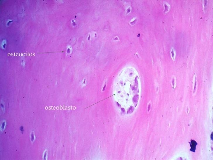 OSTEOCITOS Ubicación: estructura del hueso, alojada en lagunas óseas Fuente: Google Imágenes Célula madura, morfología