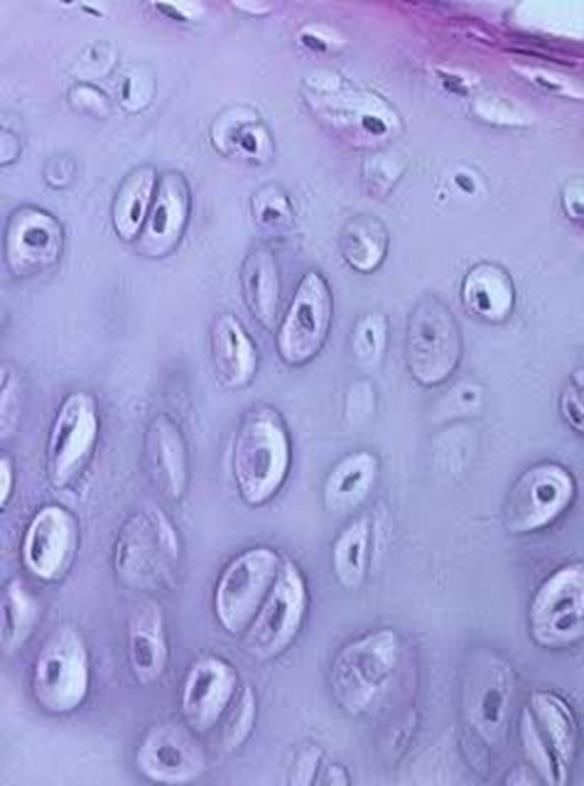Sustancia Intercelular Matriz Cartilaginosa