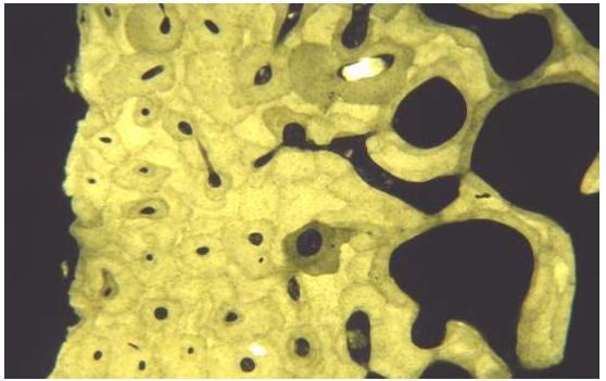 Fig. 5 y 6. Cortes transversales de tejido óseo maduro laminado compacto.