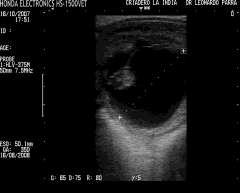(E) embrión ubicado en la parte media de la vesícula, se