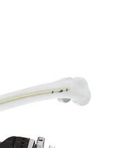 La punta de la aguja guía indica la posición que ocupará la punta del elemento cefálico cuando esté correctamente implantado.