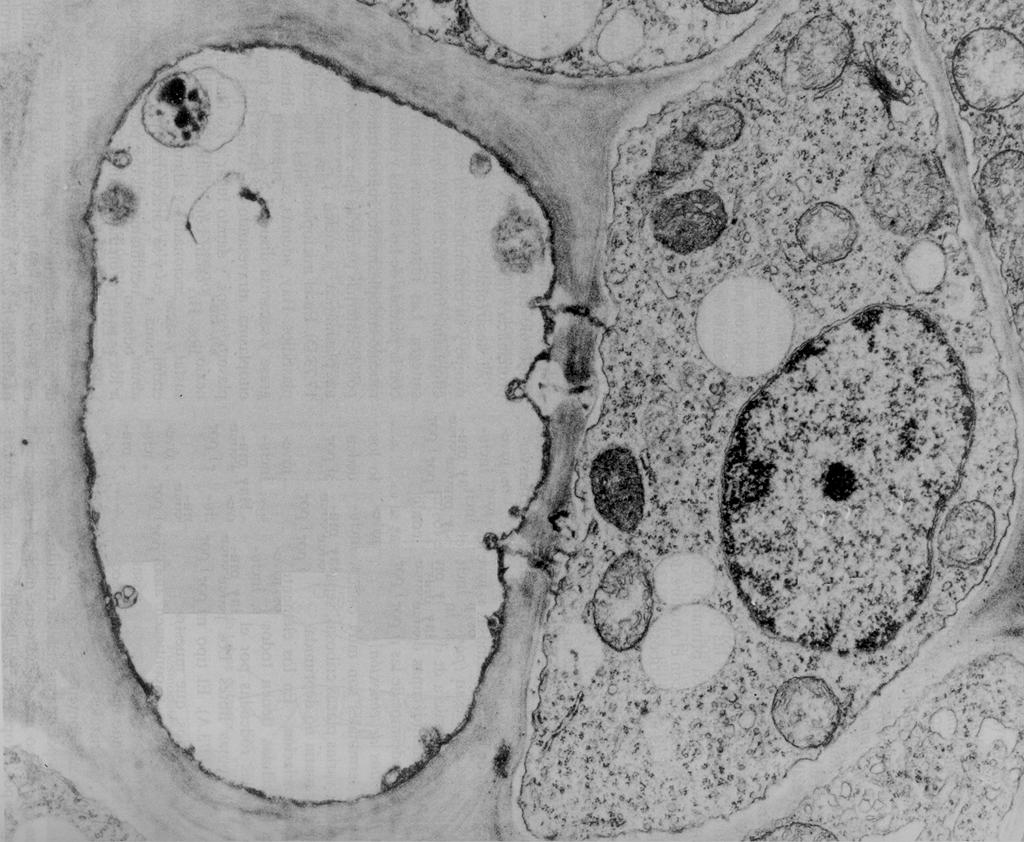 Micrografía electrónica de una sección transversal de un tubo criboso ( ) y de una célula anexa ( ) en