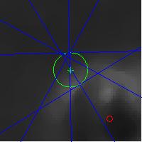 e irradiamos con un campo estrecho para formar el patrón típico de estrella que puede verse en la Figura 29. Se determina el eje de cada haz de radiación como el centro del campo.