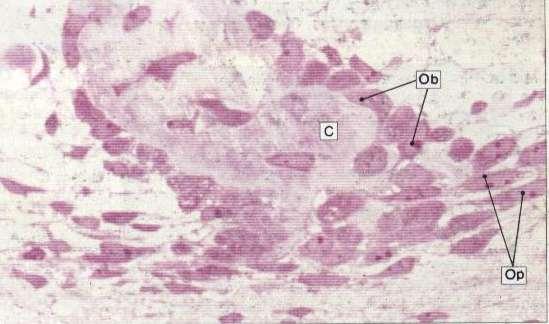 Biología de la formación ósea Diferenciación de la célula mesenquimal regulada por genes Osteoblastos,