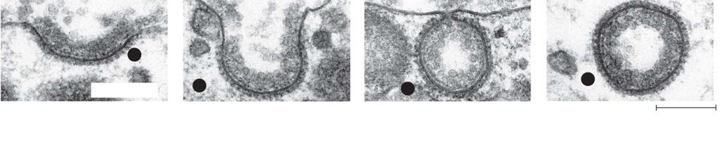 (cytoplasm) (a) Receptor-mediated endocytosis coated vesicle 4 A vesicle ("coated vesicle") containing the bound