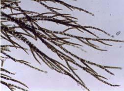 algunas veces epifitas sobre otras algas.