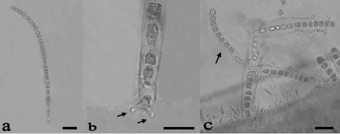 22/04/2015, epífita de Neosiphonia sp.; Ingeniero, 31/08/2015, epífita de Polysiphonia denudata; Gallega, 25/05/2016, epífita de Anotrichium tenue y Chroodactylon ornatum. Figura 3.