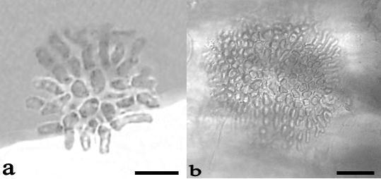 Figura 4. Sahlingia subintegra: a. Talo joven. b. Talo desarrollado. Escala: 10 μm en figura a; 25 μm en figura b.