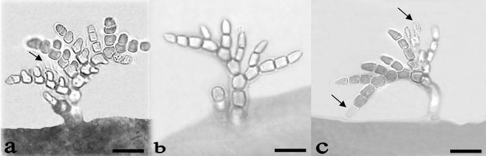 secunda y Laurencia microcladia; de Enmedio, 22/04/2015, epífita de Centroceras sp. y Neosiphonia sp. Figura 6. Acrochaetium microscopicum: a, b y c.