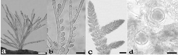 Figura 8. Colaconema hallandicum: a. Aspecto general del talo. b. Detalle de monosporangios. Crouania attenuata: c. Ramas de aspecto lanoso. d. Tetrasporangios tetraédricos.