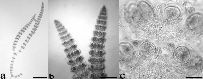 Figura 15. Ceramium sp.: a. Aspecto general del talo. b. Ramas erectas con verticilos de tetrasporangios. c. Detalle de los tetrasporangios.
