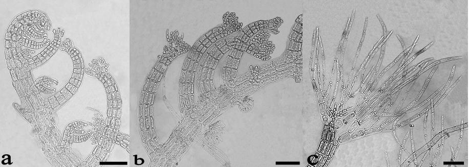 Figura 20. Herposiphonia delicatula: a. Aspecto general del talo. b. Ápice de rama con tricoblastos. c. Detalle de rizoides. Escala: 200 μm en figura a; 50 μm en figura b; 50 μm en figura c. 22.