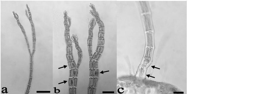 Figura 24. Neosiphonia cf. ferulacea: a. Eje postrado con rizoides. b. Rama con cistocarpos inmaduros (cabezas de flecha) y estiquidios espermatangiales (flechas). c. Detalle de estiquidio espermatangial.