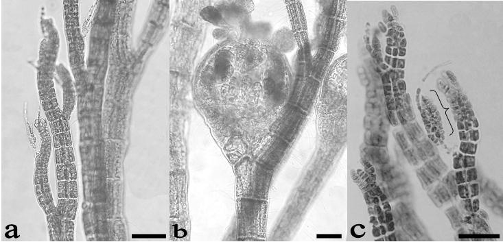 160-170 µm de diámetro, con segmentos de 140-160 µm de longitud. Ejes y ramas cilíndricos en corte transversal con cinco a seis células pericentrales.