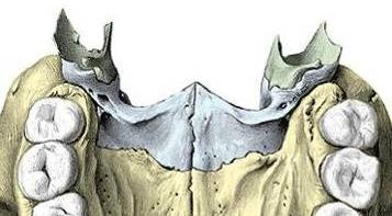 - Lámina perpendicular o vertical.- Irregularmente rectangular. a) Cara medial o interna, forma parte de la pared externa de las fosas nasales.