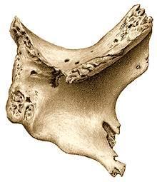 Cara medial o interna, comprende dos segmentos: Segmento anterior o articular, que se articula con el vértice de la apófisis cigomática del maxilar.