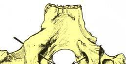 Lateralmente presenta crestas curvas, para inserciones musculares (recto anterior mayor y menor del cuello). Cara endocraneal.