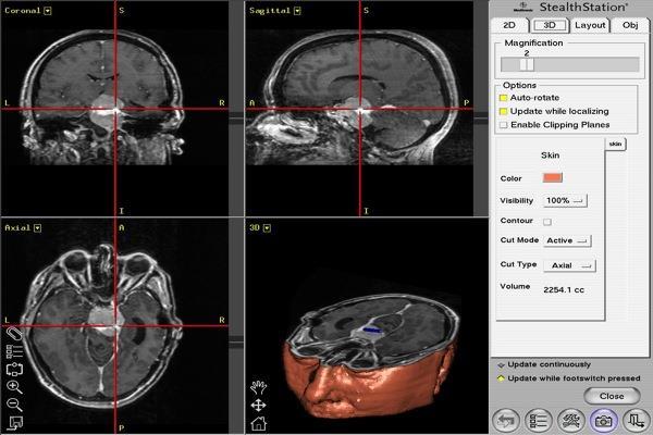 diagnóstica neurocirugías complejas Resultados