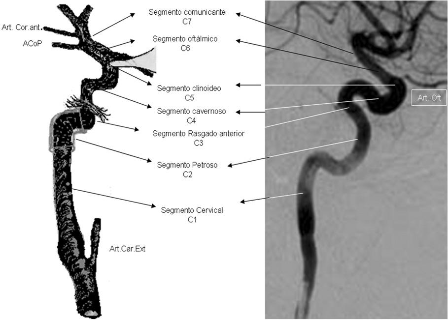 La arteria carótida externa da origen a una gran cantidad de ramas. Arteria carótida interna Es la continuación de la bifurcación de la arteria carótida común.