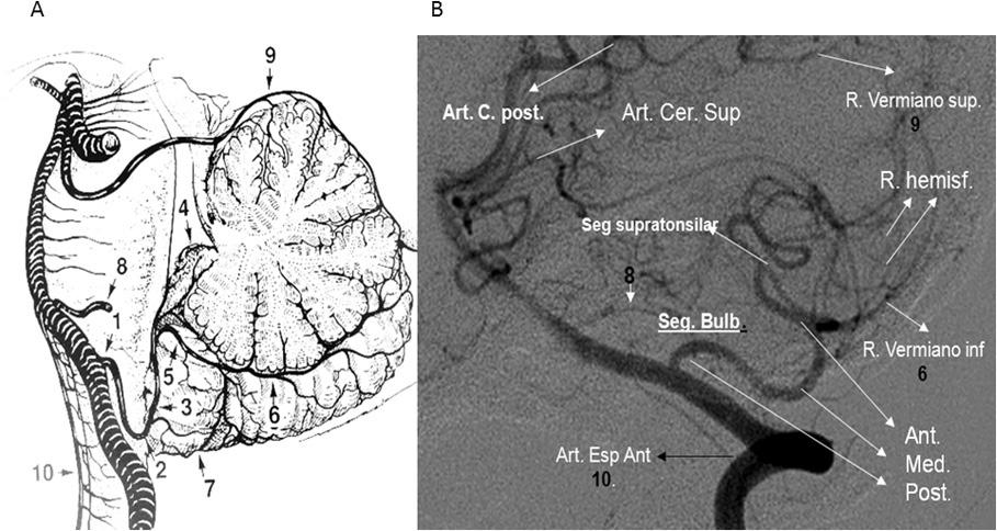 Anatomía y fisiopatología de la enfermedad cerebrovascular a través de imágenes 7 Ramos meníngeos anteriores y posteriores: nacen del segmento distal V2 de la arteria vertebral.