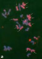 Citogenética: Estudio de la morfología del cromosoma
