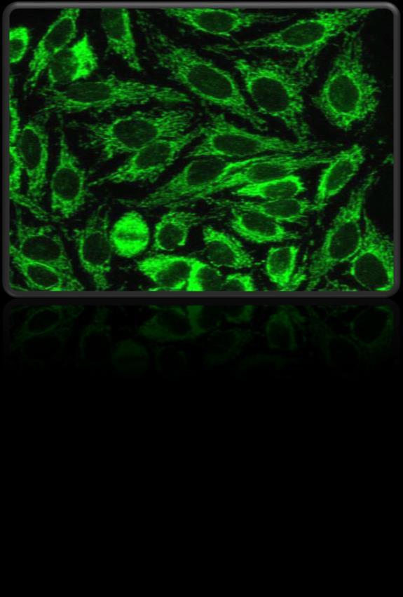 Patrón Tipo Mitocondrial: Gránulos gruesos e irregulares en el citoplasma de las células Hep-2.