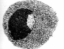 LINFOCITO B Célula plasmática en Apoptosis Características: La célula c