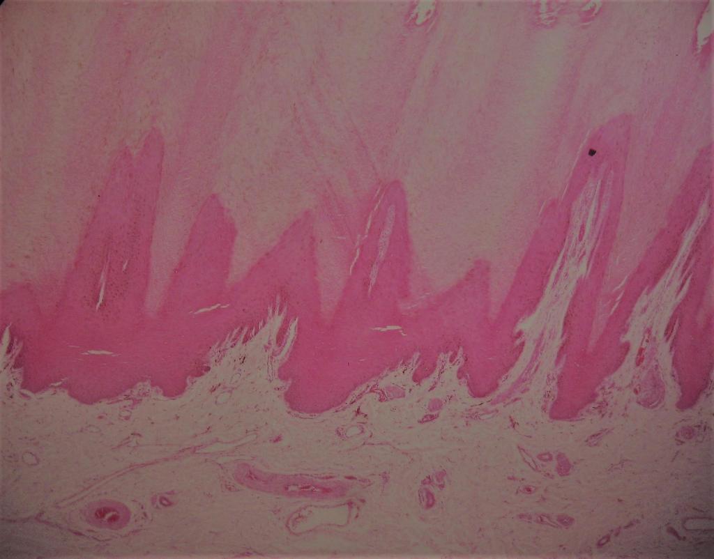 Órgano: piel gruesa Se puede apreciar en el corte histológico las estructuras que acompañan la unión dermo-epidermal.
