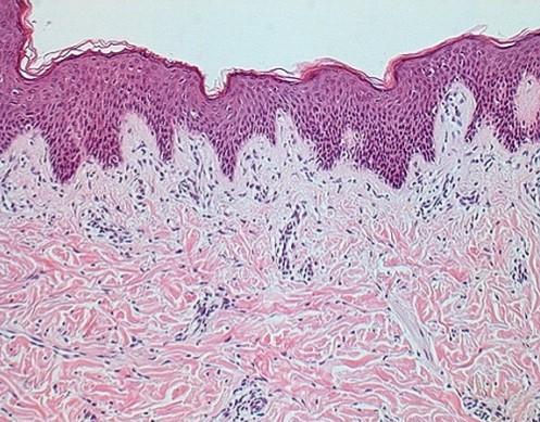 Órgano: piel fina P R Prestando atención hacia la dermis, pueden observarse las dos porciones que componen a esta capa de la piel: la dermis papilar (P), que