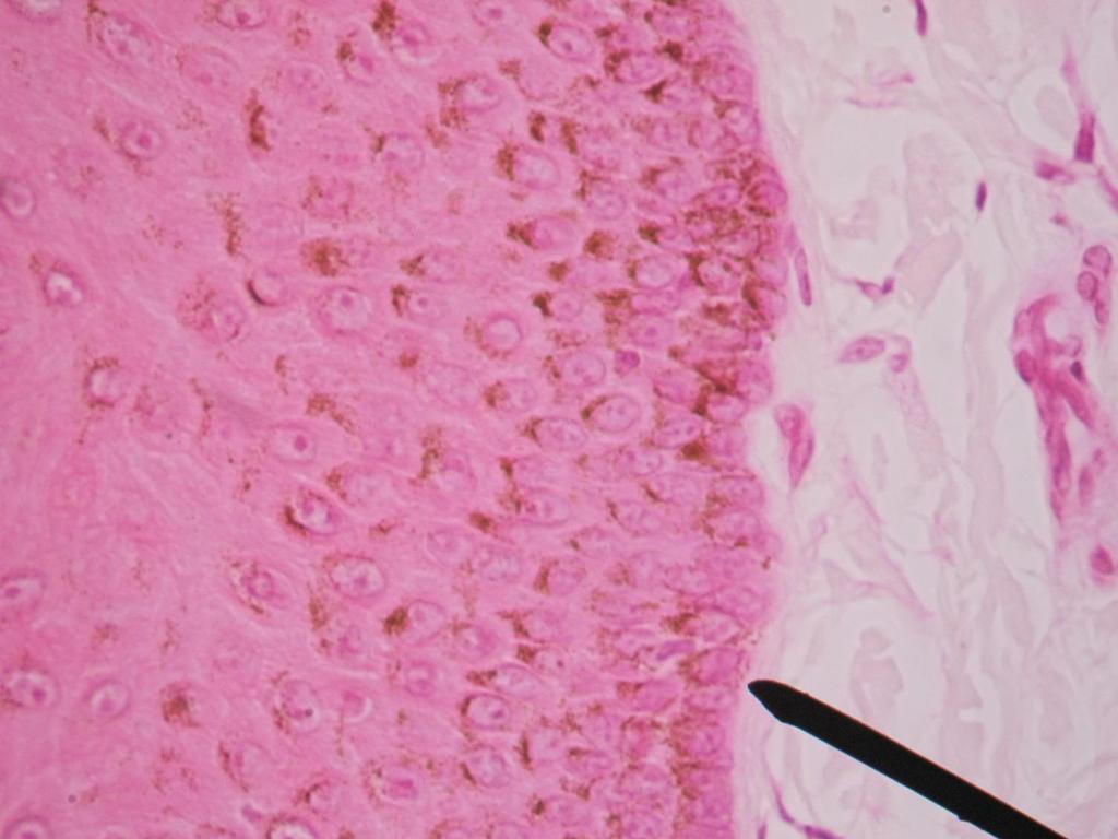 Organo: Piel E El indicador señala el estrato basal de la epidermis, formado por una sola capa de células de morfología cilíndrica, con núcleos ovoides, prominentes, citoplasma acidófilo de aspecto