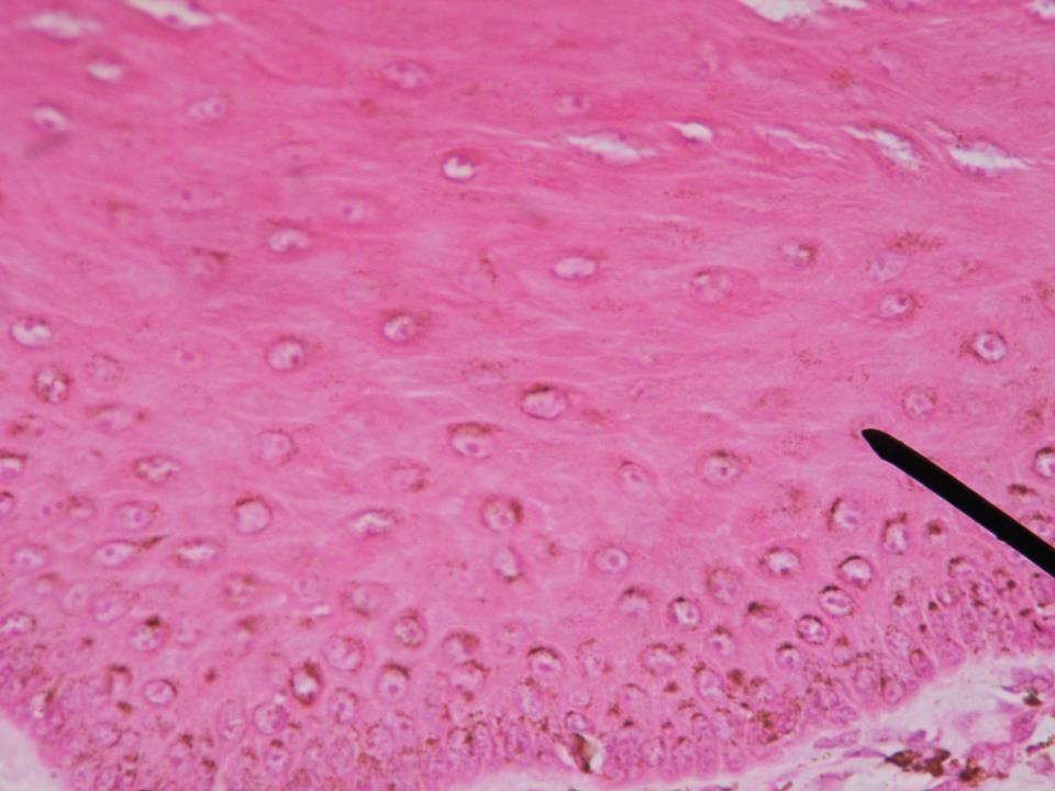 Órgano: Piel 1 En el corte histológico pueden apreciar las células del estrato espinoso