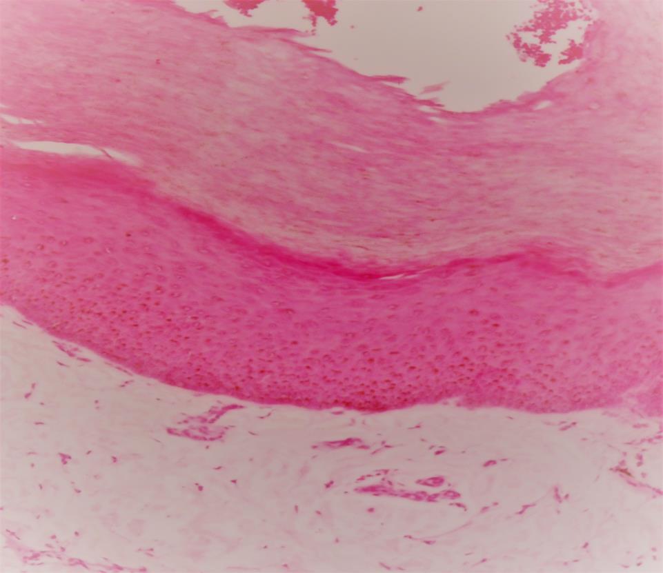 PIEL FINA VS. PIEL GRUESA Nótese la diferencia entre piel fina (izquierda) y piel gruesa (derecha), vistas bajo microscopio óptico.