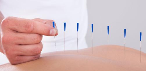 La acupuntura se emplea para aliviar síntomas tales como: náuseas, dolor, sequedad de boca, trastornos digestivos, dolores de cabeza, neuropatía, insomnio y fatiga, etc.