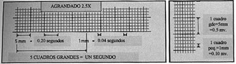Matiz y Cols. 200 milisegundos (0,2 segundos). La calibración o estandarización es una señal de un milivoltio (mv) que produce una deflexión de 10 milímetros.