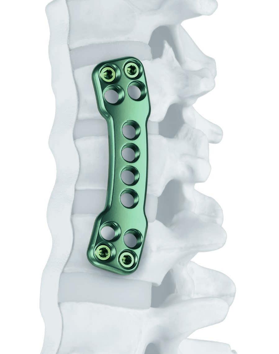 Placa de fijación vertebral torácico-lumbar Placa de