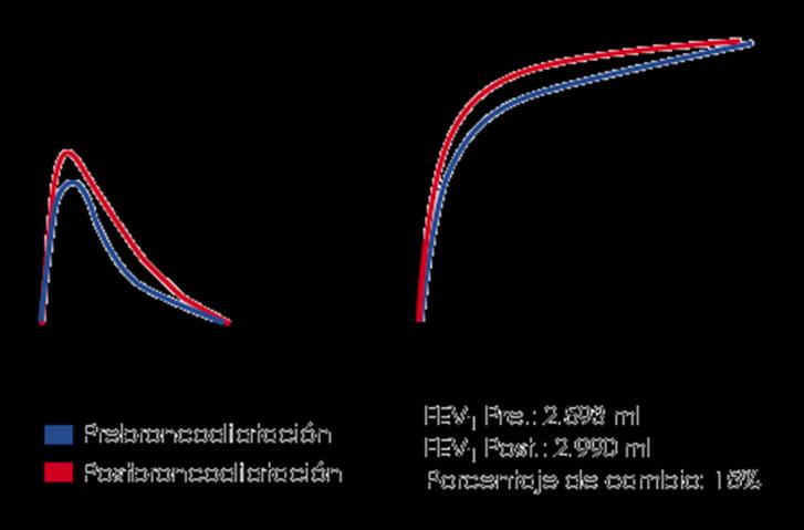 Si en la espirometría basal hay obstrucción FEV1/FVC<70% se indicara la PBD