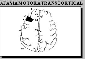Afasia transcortical motora Anomia. No fluida.